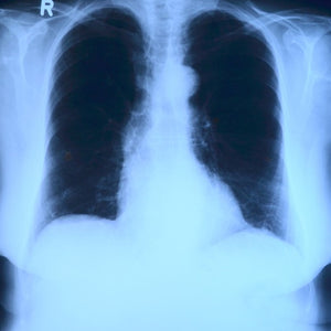 Tips for Maintaining Healthy Lungs
